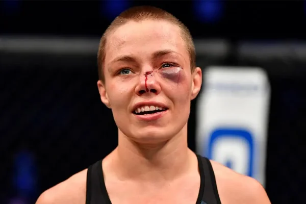 Rose Namajunas Cleared to Resume Training After Eye Surgery